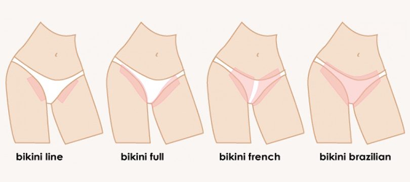 Comment s'épiler les lèvres du maillot seule