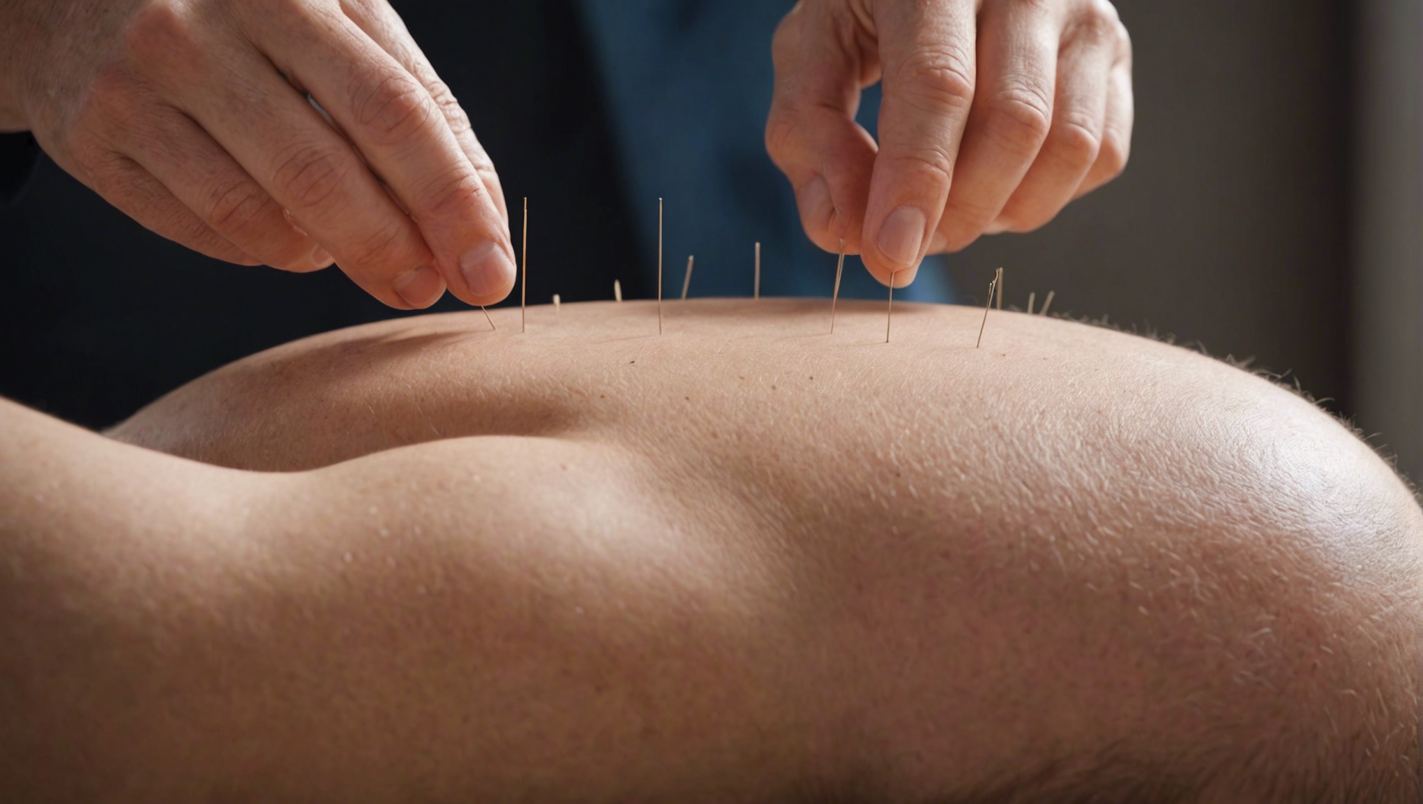 découvrez comment l'acupuncture peut potentiellement aider à la perte de poids et à la gestion de l'appétit. consultez notre guide sur l'acupuncture pour maigrir.